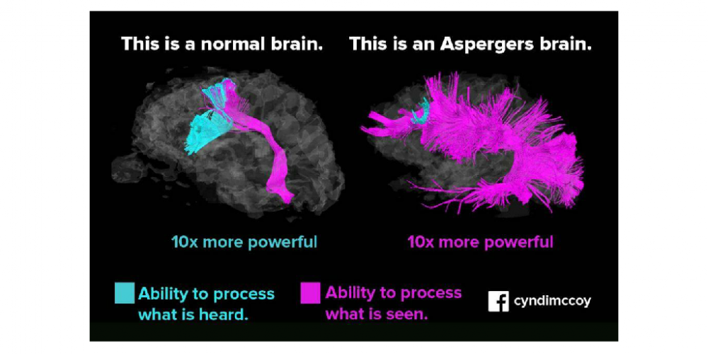 Aspergers visual brain.jpg