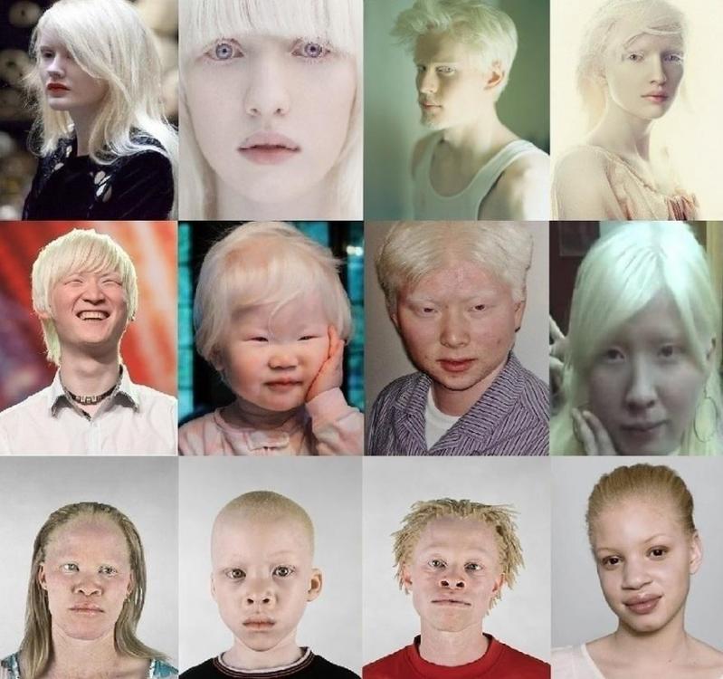 Albino Races.jpg