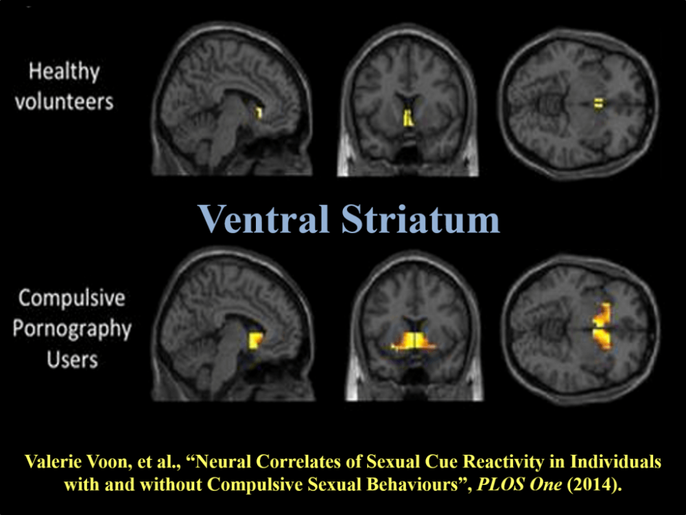 porn-on-the-brain-1024x769.png