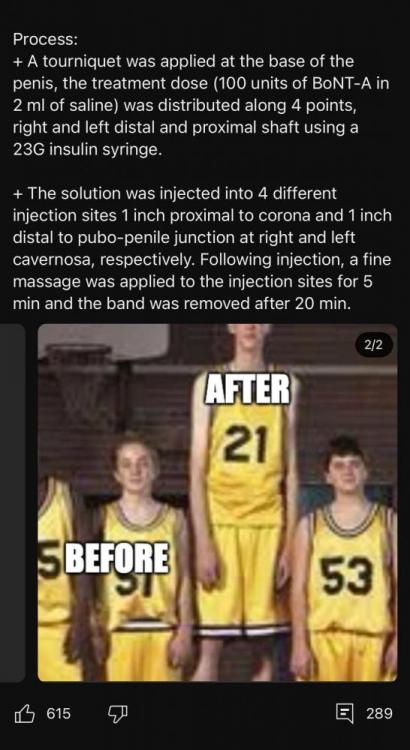 botox-injection-into-bryans-johnson-v0-6hameuay4vfc1.jpg
