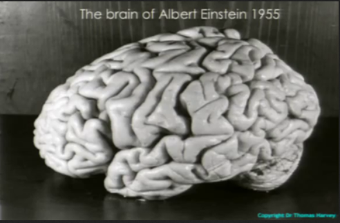 brain.png